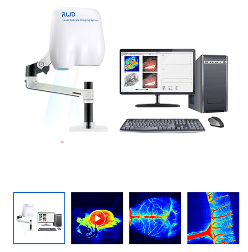 Laser speckle neuroimaging system