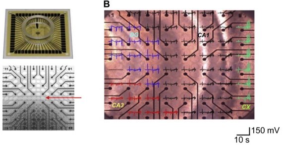 Brain slice electrophysiology data