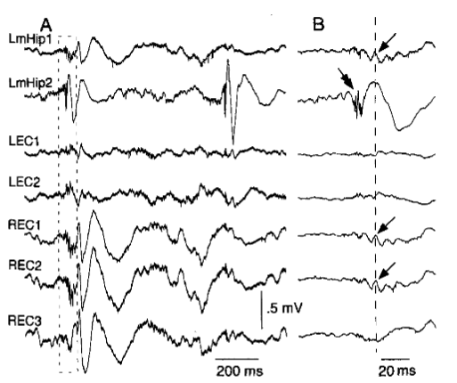 High-frequency oscillation waveform
